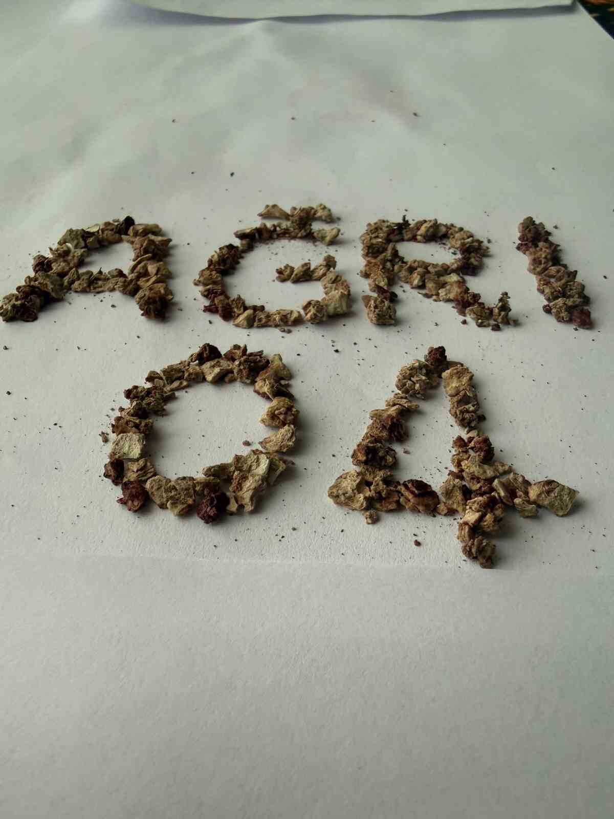 Ağrı'da zorlu taş cerrahisi başarıyla gerçekleştirildi